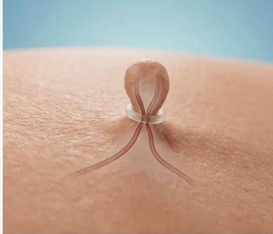 Posez le micro-élastique